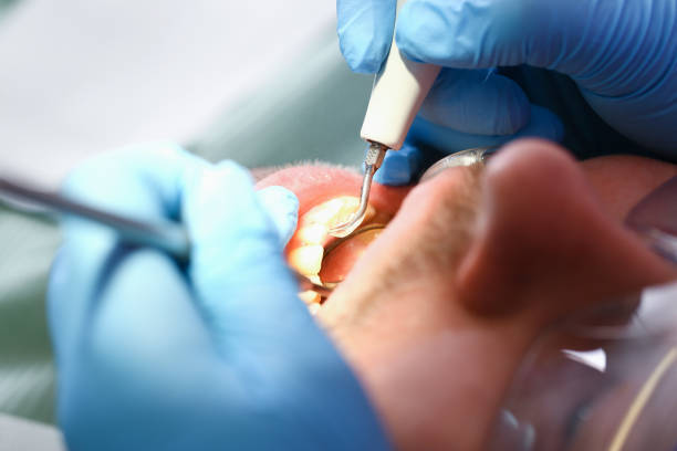 Best Emergency Treatment for Toothache in Lake Secession, SC